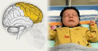 শিশুদের মস্তিষ্ক পর্যবেক্ষণে যুগান্তকারী আবিষ্কার; মিলবে রোগের আগাম তথ্য